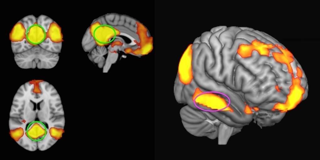 Image of a brain 3D brain scan